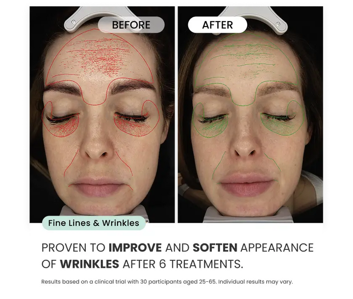 Radiant Skin Micro-Infusion System™