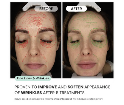 Radiant Skin Micro-Infusion System™