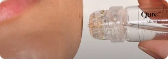 Radiant Skin Micro-Infusion System™