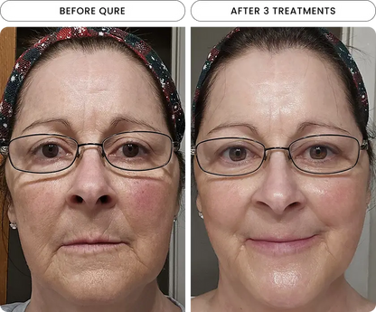 Radiant Skin Micro-Infusion System™