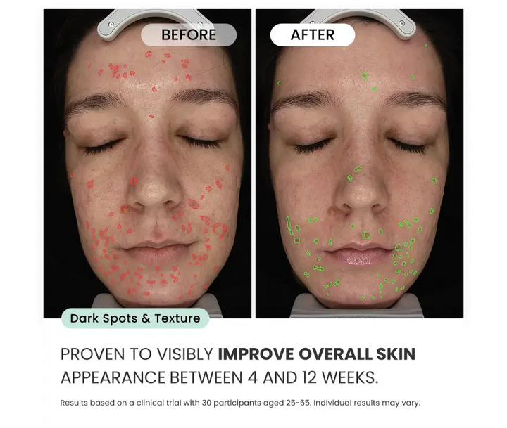 Radiant Skin Micro-Infusion System™