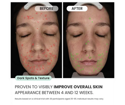 Radiant Skin Micro-Infusion System™